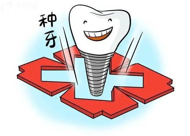 以色列雅定種植牙是什么檔次的