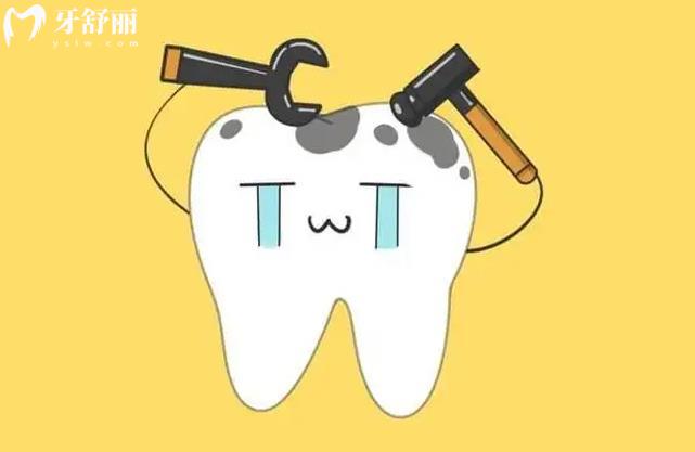 補牙的材料