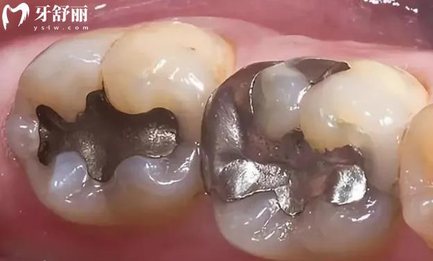 玻璃離材料