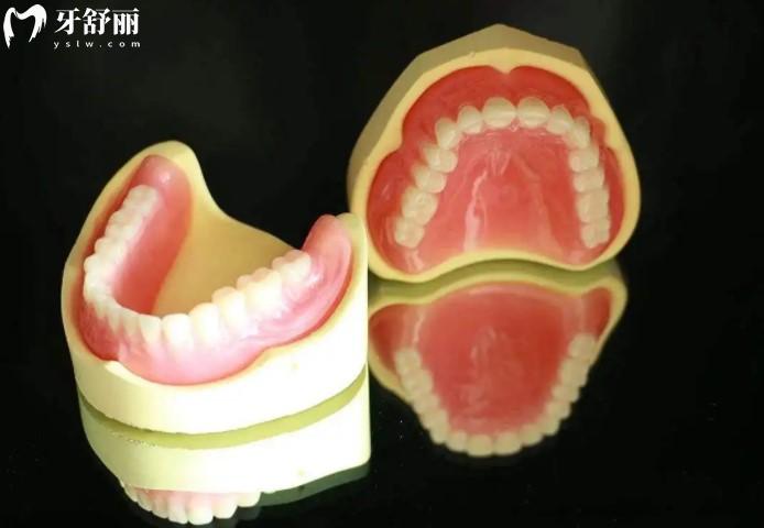 吸附性義齒