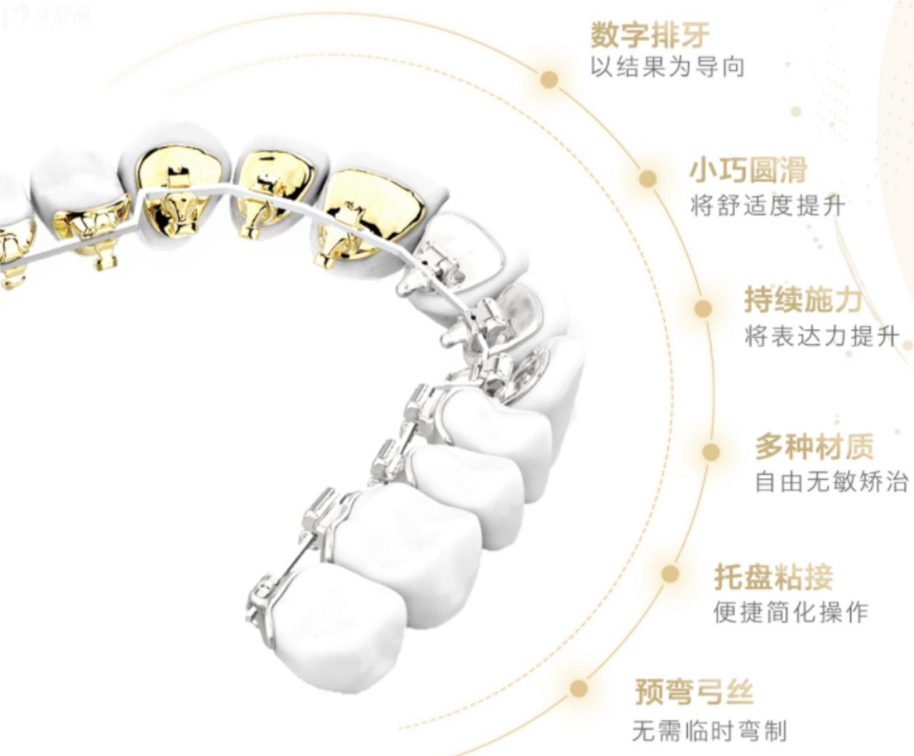 個性化舌側(cè)矯治器