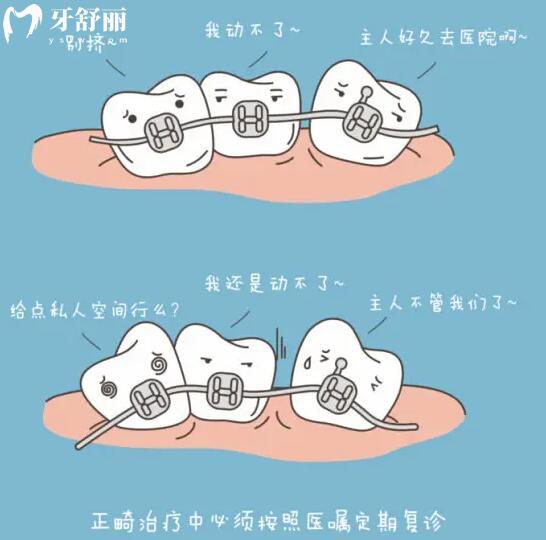 請問小孩牙齒矯正可以用隱適美牙套嗎？.jpg