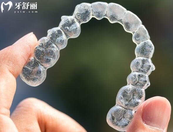 30歲了可以帶牙套做牙齒矯正嗎?牙套要帶幾年呢?.jpg