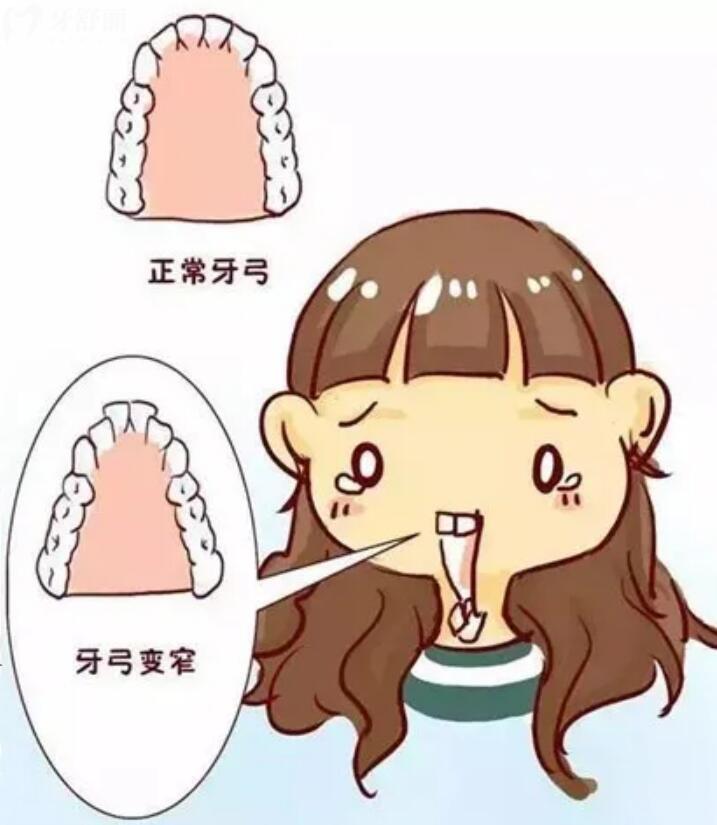 孩子有點齙牙需要矯正嗎？