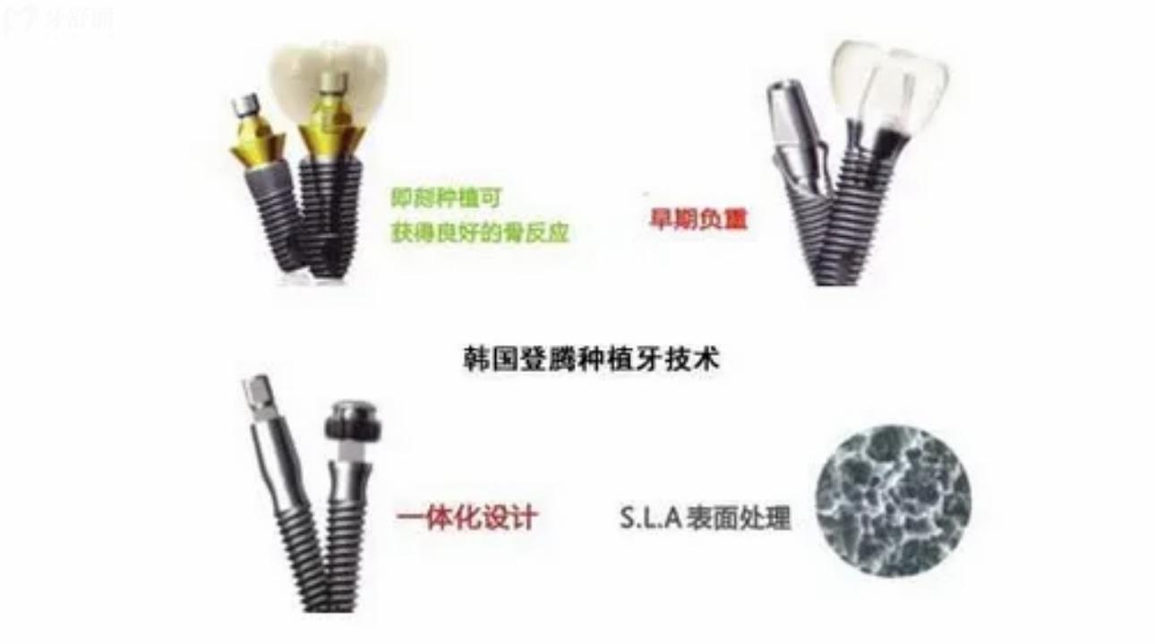 韓國(guó)登騰Dentium種植體