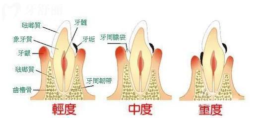 4黃石牙科收費(fèi)價(jià)目表 一般拔牙 補(bǔ)牙 種牙 整牙多少錢？