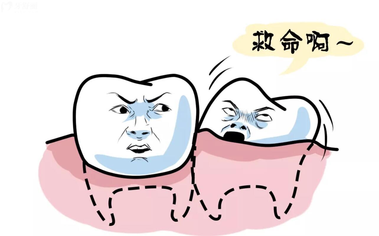 智齒拔出后空洞什么時(shí)候能長滿?。渴裁礃拥闹驱X難拔
