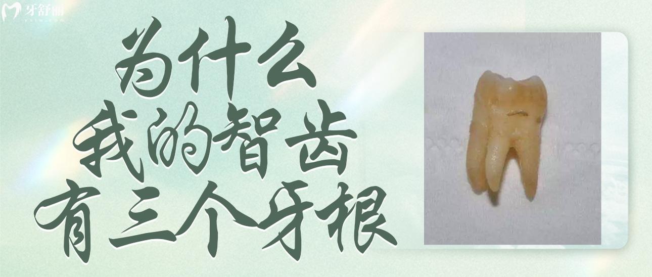 為什么我的智齒有三個牙根呢？正常嗎？