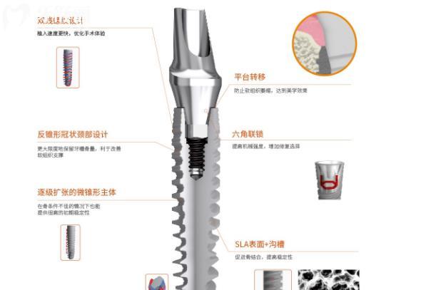 廈門百齒泰種植系統(tǒng)