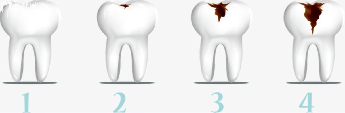大牙爛了只剩一點(diǎn)空殼了可以拔掉嗎？怎么辦還有必要保留嗎