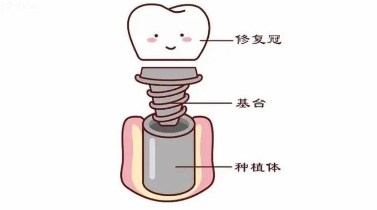 深圳薈悅城口腔診所怎么樣?聽說看牙價不貴？