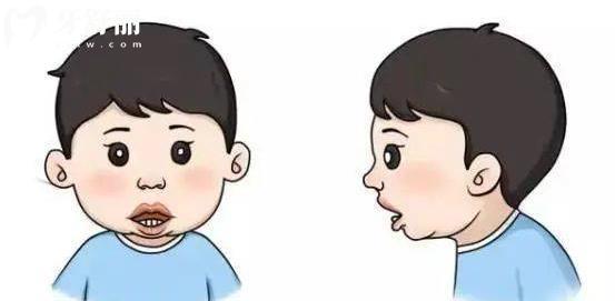 牙科中兒童顏面管理都是什么 提早干預重要嗎？