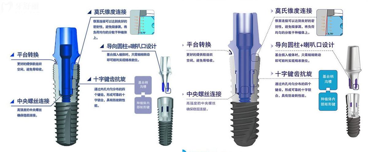 濟(jì)南種植牙多少錢(qián)一顆 濟(jì)南牙科23年新版價(jià)目表更新 