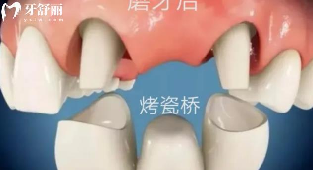烏魯木齊牙科價格表