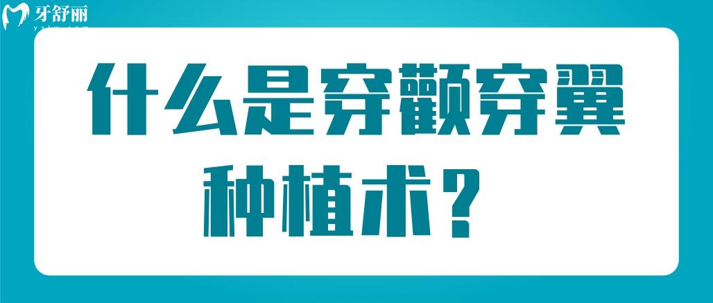 穿顴穿翼種植術(shù)
