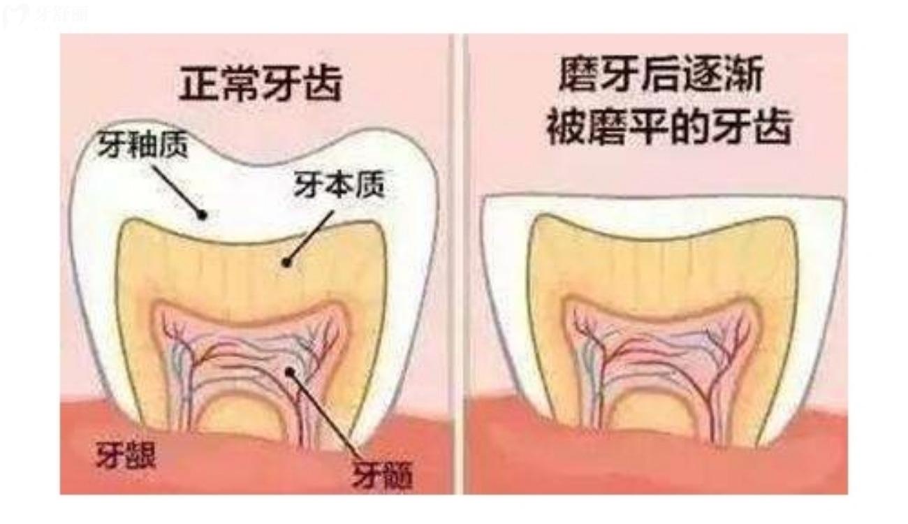 經(jīng)常夜磨牙是怎么回事.jpg