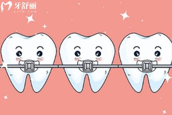 牙齒矯正卡通圖.jpg