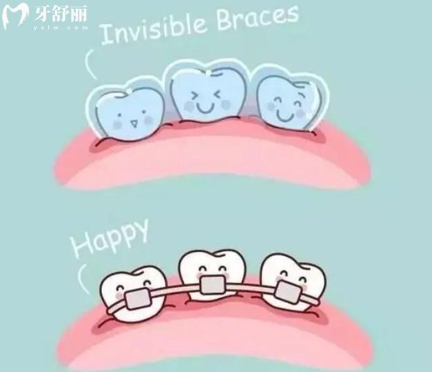牙齒矯正
