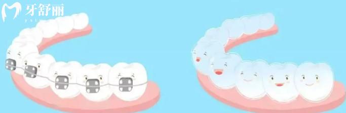 福州同步名康口腔門(mén)診部牙齒矯正怎么樣