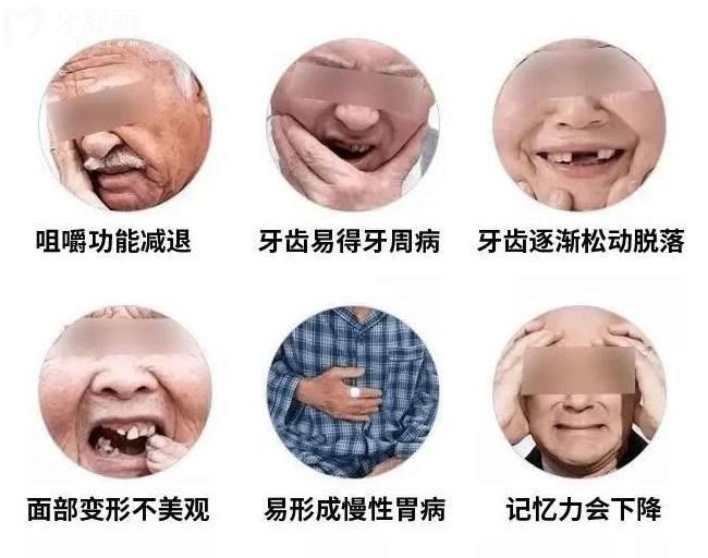 為什么要做種植牙