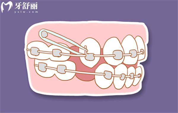 昆明口腔醫(yī)院收費貴嗎