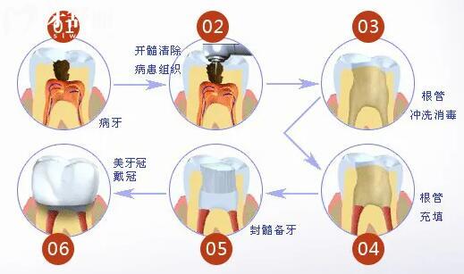 汕頭德瑞口腔醫(yī)院價(jià)格表已出,深挖補(bǔ)牙/拔牙/種植牙/正畸多少錢(qián)