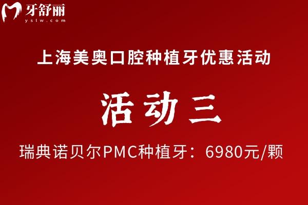 上海美奧口腔諾貝爾種植牙優(yōu)惠活動