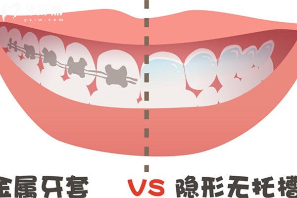 天津**矯正價格