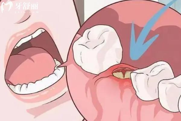 合肥咿博口腔醫(yī)院好不好？雙手奉上技術優(yōu)勢和乘車路線