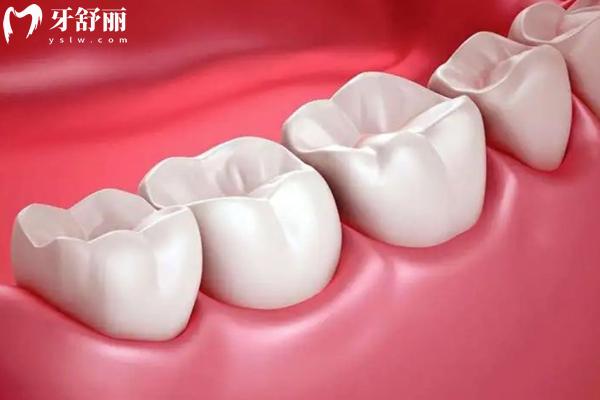 武漢半口維他靈活動(dòng)義齒支架多少錢