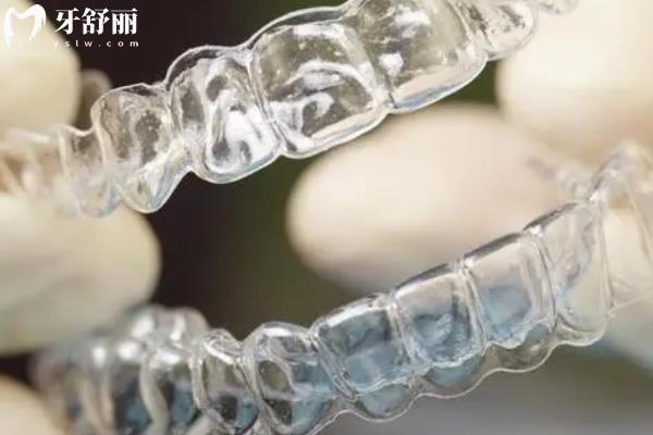 全隱形牙套
