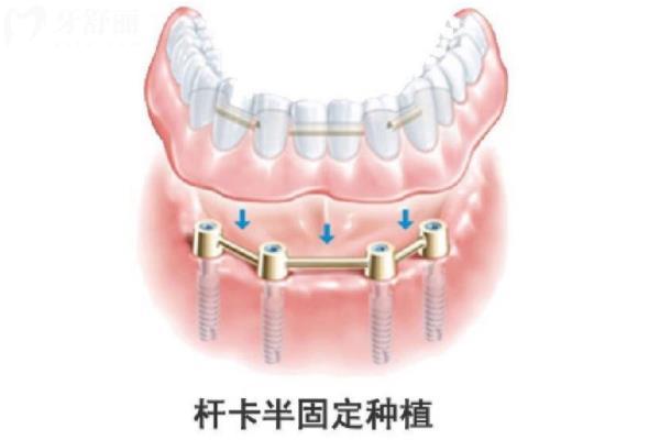 連云港牙科收費(fèi)價(jià)目表