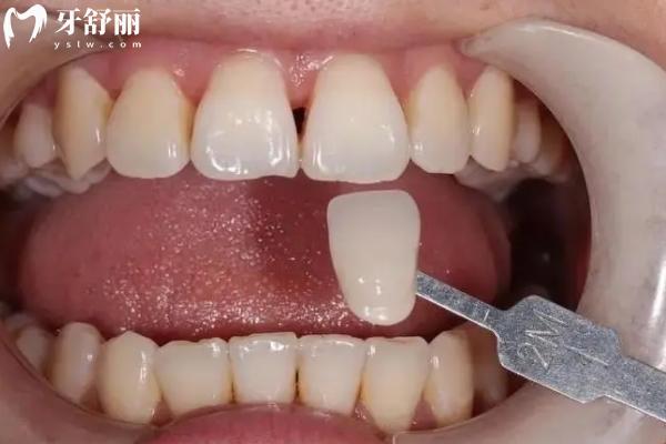高郵牙科醫(yī)院收費標準