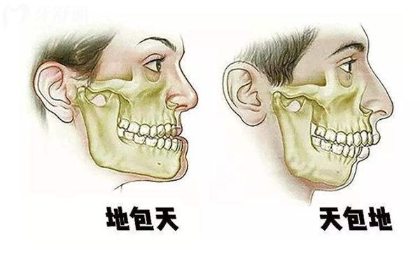 北京大學(xué)口腔醫(yī)院做正頜手術(shù)怎么樣