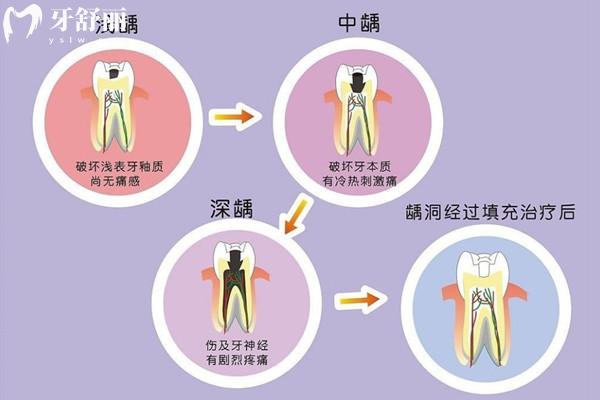 資陽牙科醫(yī)院收費(fèi)標(biāo)準(zhǔn)表