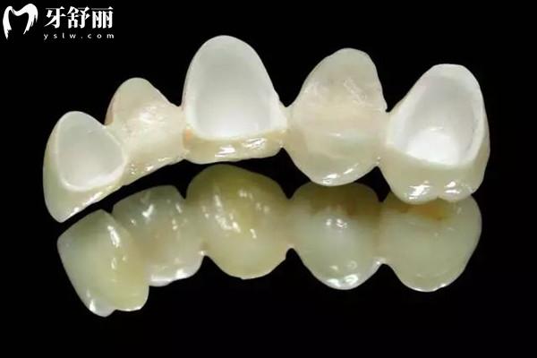 資陽牙科醫(yī)院收費(fèi)標(biāo)準(zhǔn)表