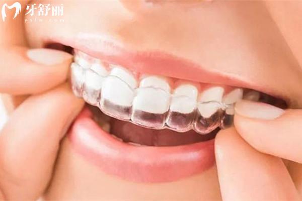 青白江區(qū)牙科醫(yī)院收費(fèi)價(jià)目表