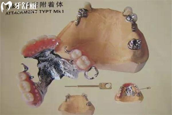 呼倫貝爾牙科醫(yī)院收費(fèi)標(biāo)準(zhǔn):種植牙3000+牙齒矯正6000+鑲牙冠800+