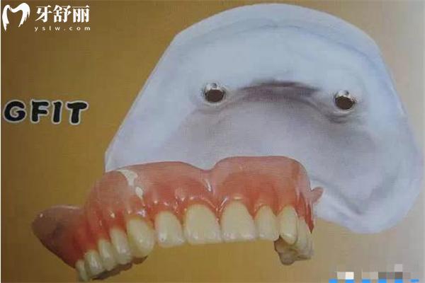 假牙