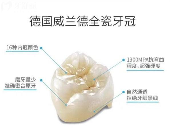 德國威蘭德全瓷牙冠