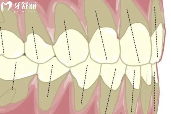 牙齒用手晃有點(diǎn)松動(dòng)正常嗎？會(huì)自己長(zhǎng)好嗎？