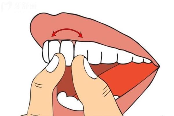 牙齒用手晃有點(diǎn)松動(dòng)正常嗎？會(huì)自己長(zhǎng)好嗎？