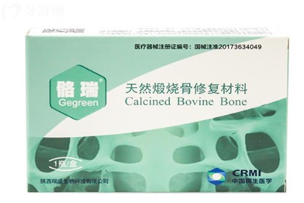 種牙加骨膜骨粉后4個(gè)月可以裝牙嗎?價(jià)格收費(fèi)好幾千是不是忽悠啊?