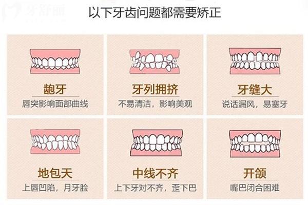 牙齒畸形形成的原因有哪些