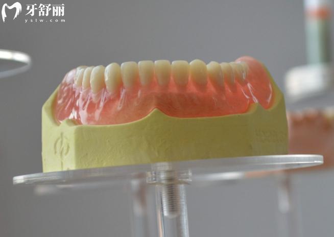 網(wǎng)上買(mǎi)的義齒可靠嗎