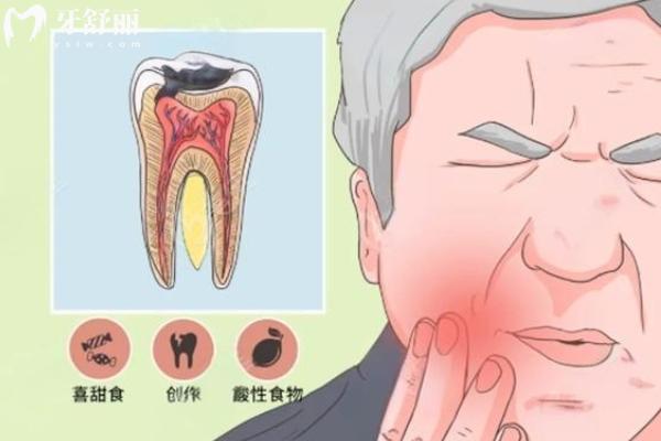 根尖周炎能自愈嗎？
