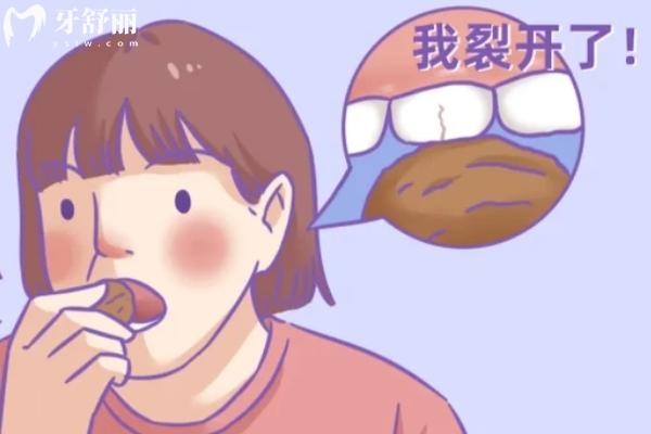 安了假牙吃什么東西都可以嗎？