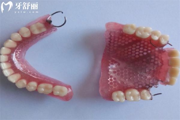 上海鼎植口腔醫(yī)院全口活動假牙多少錢