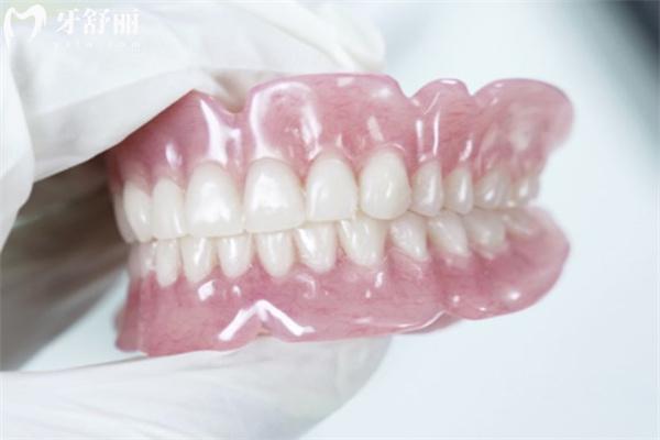 上海鼎植口腔醫(yī)院全口吸附性義齒多少錢