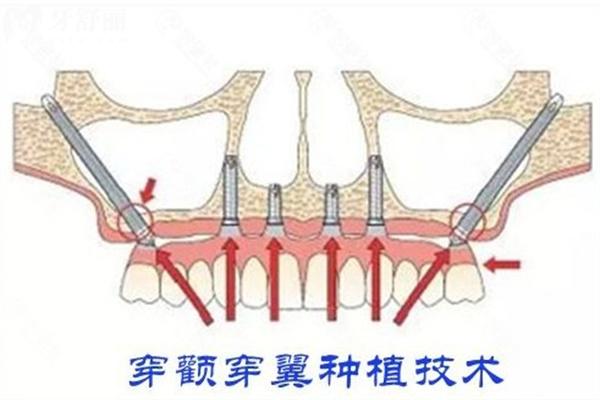 更新樺甸牙科收費(fèi)價格表:附樺甸牙科診所哪個好名單及地址